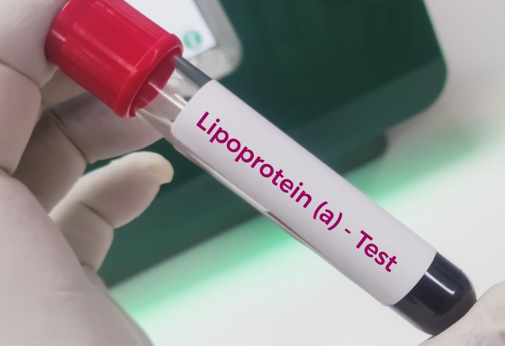 Cholesterol drug setback casts doubt over multibillion-dollar race